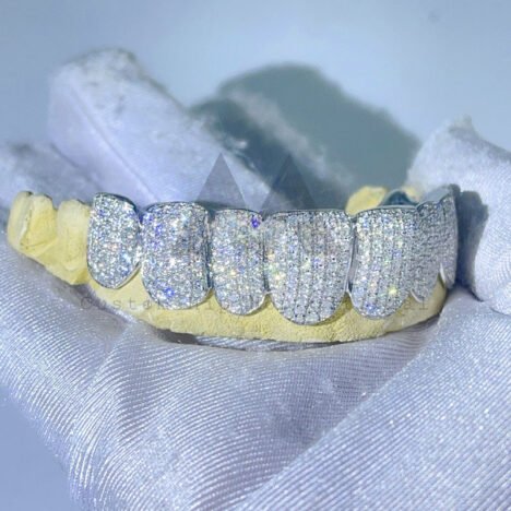 VVS Moissanite 10k White Gold Custom Grillz - Solid Hip Hop Jewelry - Image 2