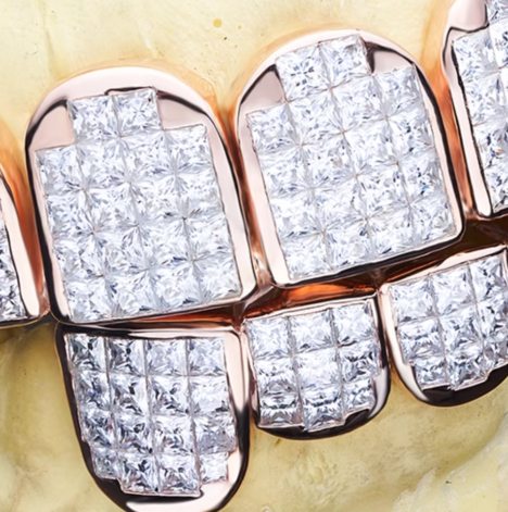 Rose Gold Plated Silver Moissanite Diamond Grillz, 6 Top 6 Bottom Set, Hip Hop Jewelry - Image 2