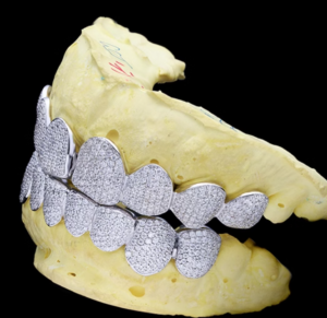 Custom Iced Out Moissanite Diamond Grillz, Zig Zag Set, Hip Hop Jewelry - Image 3